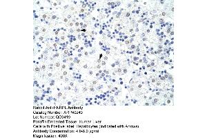 Rabbit Anti-HNRPL Antibody  Paraffin Embedded Tissue: Human Liver Cellular Data: Hepatocytes Antibody Concentration: 4. (HNRNPL anticorps  (N-Term))