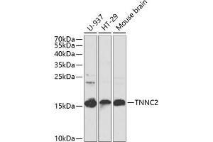 Western blot analysis of extracts of various cell lines, using TNNC2 antibody (ABIN6129604, ABIN6149353, ABIN6149354 and ABIN6223680) at 1:1000 dilution. (TNNC2 anticorps  (AA 1-160))