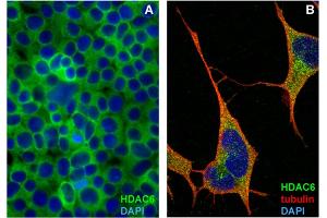 Immunocytochemistry staining of HDAC6 in formaldehyde-fixed and Triton-permeabilized HEK-293T cells (A) and SH-SY5Y cells (B) by mouse monoclonal antibody 159, followed by anti-mouse Alexa Fluor 488 (green), DNA indicated by DAPI (blue).