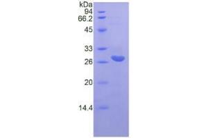 SDS-PAGE analysis of Rat IL22Ra2 Protein. (IL22RA2 Protéine)