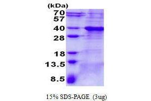 Figure annotation denotes ug of protein loaded and % gel used. (BCL7A Protéine)