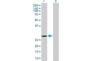 Western Blot analysis of KCTD6 expression in transfected 293T cell line by KCTD6 MaxPab polyclonal antibody. (KCTD6 anticorps  (AA 1-237))