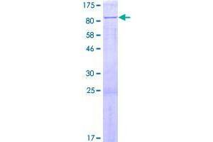 Image no. 1 for CTD (Carboxy-Terminal Domain, RNA Polymerase II, Polypeptide A) Small Phosphatase Like 2 (CTDSPL2) (AA 1-466) protein (GST tag) (ABIN1350644)