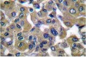 Image no. 1 for anti-Keratin 7 (KRT7) antibody (ABIN265502) (Cytokeratin 7 anticorps)