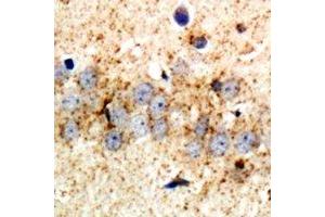 Immunohistochemistry (IHC) image for anti-Ribosomal Protein S3A (RPS3A) antibody (ABIN7308292) (RPS3A anticorps)