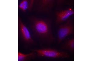 Immunofluorescence staining of methanol-fixed HeLa cells using Phospho-NTRK1-S791 antibody (ABIN2987788). (TRKA anticorps  (pSer791))