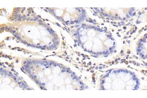 Detection of ABCB10 in Human Colon Tissue using Polyclonal Antibody to ATP Binding Cassette Transporter B10 (ABCB10)