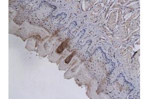 Formalin-fixed and paraffin embedded rat tongue labeled with Anti-AKR1B1 Polyclonal Antibody, Unconjugated (ABIN739785) followed by conjugation to the secondary antibody