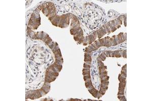 Immunohistochemical staining (Formalin-fixed paraffin-embedded sections) of human fallopian tube with ASMTL polyclonal antibody  shows cytoplasmic positivity in glandular cells. (ASMTL anticorps)