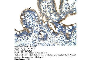 Rabbit Anti-CPNE1 Antibody  Paraffin Embedded Tissue: Human Intestine Cellular Data: Epithelial cells of intestinal villas Antibody Concentration: 4.
