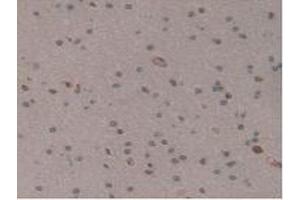 Detection of GM-CSF in Human Brain Tissue using Polyclonal Antibody to Colony Stimulating Factor 2, Granulocyte Macrophage (GM-CSF)
