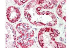 Human, Kidney: Formalin-Fixed Paraffin-Embedded (FFPE).