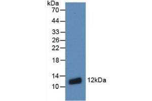 Detection of Recombinant S100A8, Human using Monoclonal Antibody to S100 Calcium Binding Protein A8 (S100A8) (S100A8 anticorps  (AA 1-93))