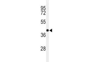 Western blot analysis of PAX-6 in Y79 lysate