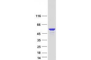Validation with Western Blot (CCDC17 Protein (Coiled coil domain) (Myc-DYKDDDDK Tag))