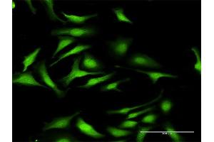 Immunofluorescence of purified MaxPab antibody to DNMT3L on HeLa cell.