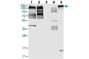Western blot analysis of Lane 1: RT-4, Lane 2: U-251 MG, Lane 3: Human Plasma, Lane 4: Liver, Lane 5: Tonsil with MLLT4 polyclonal antibody  at 1:250-1:500 dilution. (Afadin anticorps)
