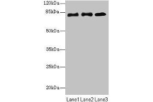 Western blot All lanes: CPEB4 antibody at 2 μg/mL Lane 1: Hela whole cell lysate Lane 2: 293T whole cell lysate Lane 3: U87 whole cell lysate Secondary Goat polyclonal to rabbit IgG at 1/10000 dilution Predicted band size: 81, 79, 37 kDa Observed band size: 81 kDa (CPEB4 anticorps  (AA 244-515))