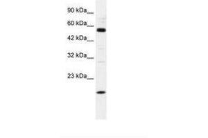 Image no. 1 for anti-Zinc Finger Protein 436 (ZNF436) (AA 104-153) antibody (ABIN202607) (ZNF436 anticorps  (AA 104-153))
