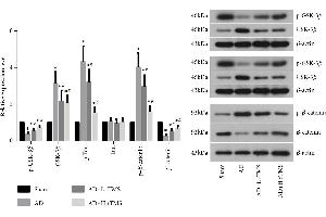 Effect of rTMS on the activities of GSK-3β, Tau, and β-catenin in AD mice.