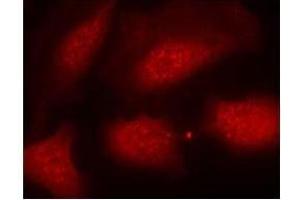 Image no. 3 for anti-Histone H3.1 (HIST1H3B) (pSer10) antibody (ABIN196922) (Histone H3.1 anticorps  (pSer10))