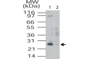 Western blot analysis of TMED4 in HL-60 cell lysates. (TMED4 anticorps  (AA 55-67))