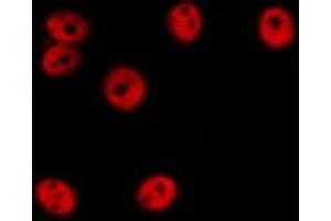 ABIN6276640 staining Hela cells by IF/ICC. (ERG anticorps  (C-Term))