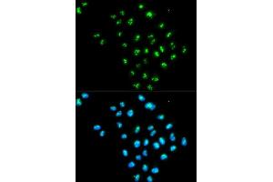 Immunofluorescence analysis of MCF-7 cells using EIF6 antibody. (EIF6 anticorps  (AA 1-245))