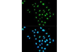 Immunofluorescence analysis of MCF-7 cells using EIF6 antibody. (EIF6 anticorps  (AA 1-245))