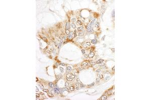 Immunohistochemistry (IHC) image for anti-Dedicator of Cytokinesis 4 (DOCK4) (AA 1725-1775) antibody (ABIN7453814)