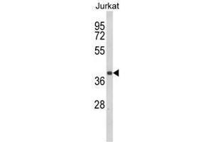 Western blot analysis of CCR3 Antibody (Center) in Jurkat cell line lysates (35ug/lane). (CCR3 anticorps  (Middle Region))