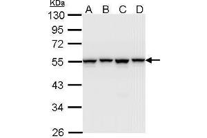 WB Image Sample (30 ug of whole cell lysate) A: A431 , B: H1299 C: Hela D: Hep G2 , 10% SDS PAGE antibody diluted at 1:1000 (HNRNPH1 anticorps)