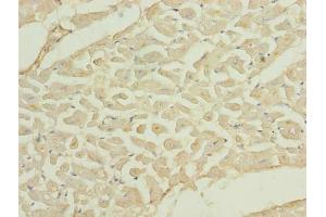 Immunohistochemistry of paraffin-embedded human heart tissue using ABIN7173395 at dilution of 1:100 (TMLHE anticorps  (AA 16-376))