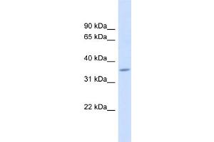 WB Suggested Anti-FAM26F Antibody Titration:  0. (FAM26F anticorps  (Middle Region))