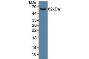 Figure. (KRT9 anticorps  (AA 315-456))