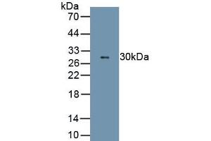Detection of Recombinant ELA2, Rat using Polyclonal Antibody to Neutrophil Elastase (NE) (ELANE anticorps  (AA 31-271))