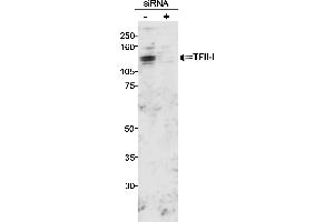 Western Blotting (WB) image for anti-General Transcription Factor III (GTF2I) (C-Term) antibody (ABIN7449365)
