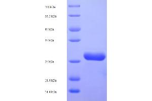SDS-PAGE (SDS) image for NADH Dehydrogenase (Ubiquinone) 1 beta Subcomplex, 5, 16kDa (NDUFB5) (AA 94-189), (partial) protein (His-SUMO Tag) (ABIN5710003)