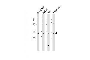 All lanes : Anti-RASSF2 Antibody (Center) at 1:2000 dilution Lane 1: SH-SY5Y whole cell lysates Lane 2: Jurkat whole cell lysates Lane 3: Raji whole cell lysates Lane 4: human placenta lysates Lysates/proteins at 20 μg per lane.