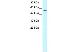 WB Suggested Anti-PNLIP Antibody Titration:  1. (PNLIP anticorps  (C-Term))
