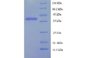 SDS-PAGE (SDS) image for DiGeorge Syndrome Critical Region Gene 6-Like (DGCR6L) (AA 1-220), (full length) protein (His-SUMO Tag) (ABIN5711883)