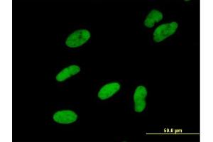 Immunofluorescence of purified MaxPab antibody to SMARCA5 on HeLa cell.