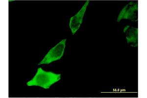 Immunofluorescence of monoclonal antibody to BDNF on HeLa cell. (BDNF anticorps  (AA 1-247))
