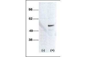 Western blot analysis of anti-STK38L Pab (ABIN392120 and ABIN2841867) transiently transfected HEK-293 cell line lysate (1 μg/lane). (STK38L anticorps  (C-Term))