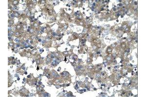 anti-Kruppel-Like Factor 15 (KLF15) (AA 45-94) antibody