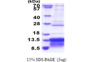 SDS-PAGE (SDS) image for Musculoskeletal, Embryonic Nuclear Protein 1 (MUSTN1) (AA 1-82) protein (His tag) (ABIN6387471)