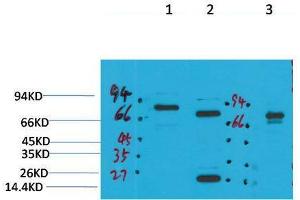Western Blot (WB) analysis of 1) Rat Brain Tissue, 2)Mouse Brain Tissue, 3) HepG2 with KCNN2(SK2) Rabbit Polyclonal Antibody diluted at 1:2000. (KCNN2 anticorps)