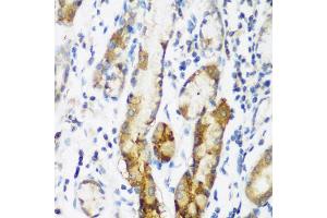 Immunohistochemistry of paraffin-embedded human gastric using NAA60 antibody (ABIN5975517) at dilution of 1/200 (40x lens). (NAT15 anticorps)