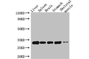 Western Blot Positive WB detected in: Mouse liver tissue, Mouse spleen tissue, Mouse brain tissue, Mouse stomach tissue, Mouse skeletal muscle tissue All lanes: GPM6A antibody at 4 μg/mL Secondary Goat polyclonal to rabbit IgG at 1/50000 dilution Predicted band size: 32, 31, 30 kDa Observed band size: 32 kDa (GPM6A anticorps  (AA 149-213))