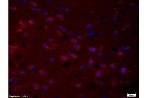 Formalin-fixed and paraffin embedded rat brain tissue labeled with Anti- phospho-PRKC Polyclonal Antibody, Unconjugated (ABIN741240) at 1:200 followed by conjugation to the secondary antibody Goat Anti-Rabbit IgG, PE conjugated used at 1:200 dilution for 40 minutes at 37°C and DAPI (PKC beta anticorps  (pThr500))